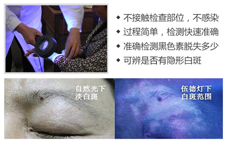揭秘白癜风治疗费用背后的故事